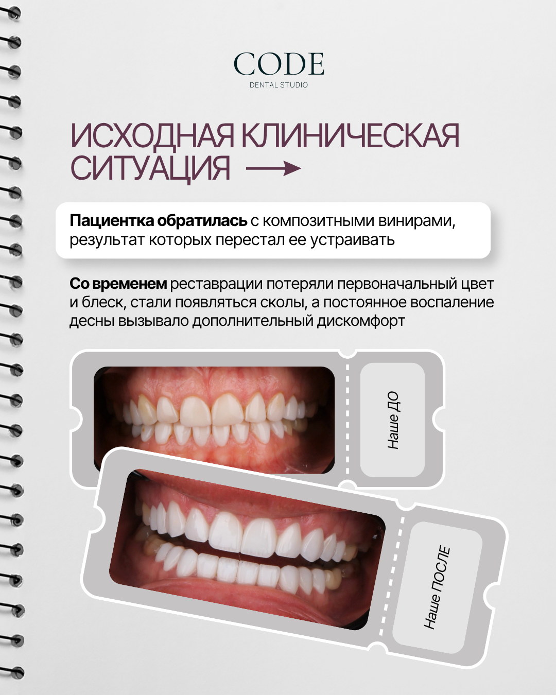 Code Dental — карусель: исходная клиническая ситуация