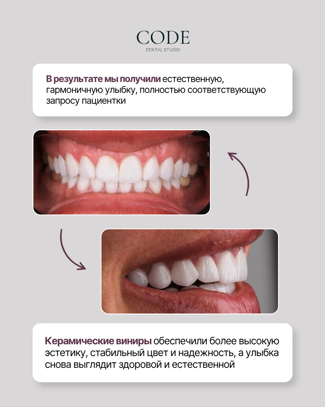 Code Dental — карусель: результат