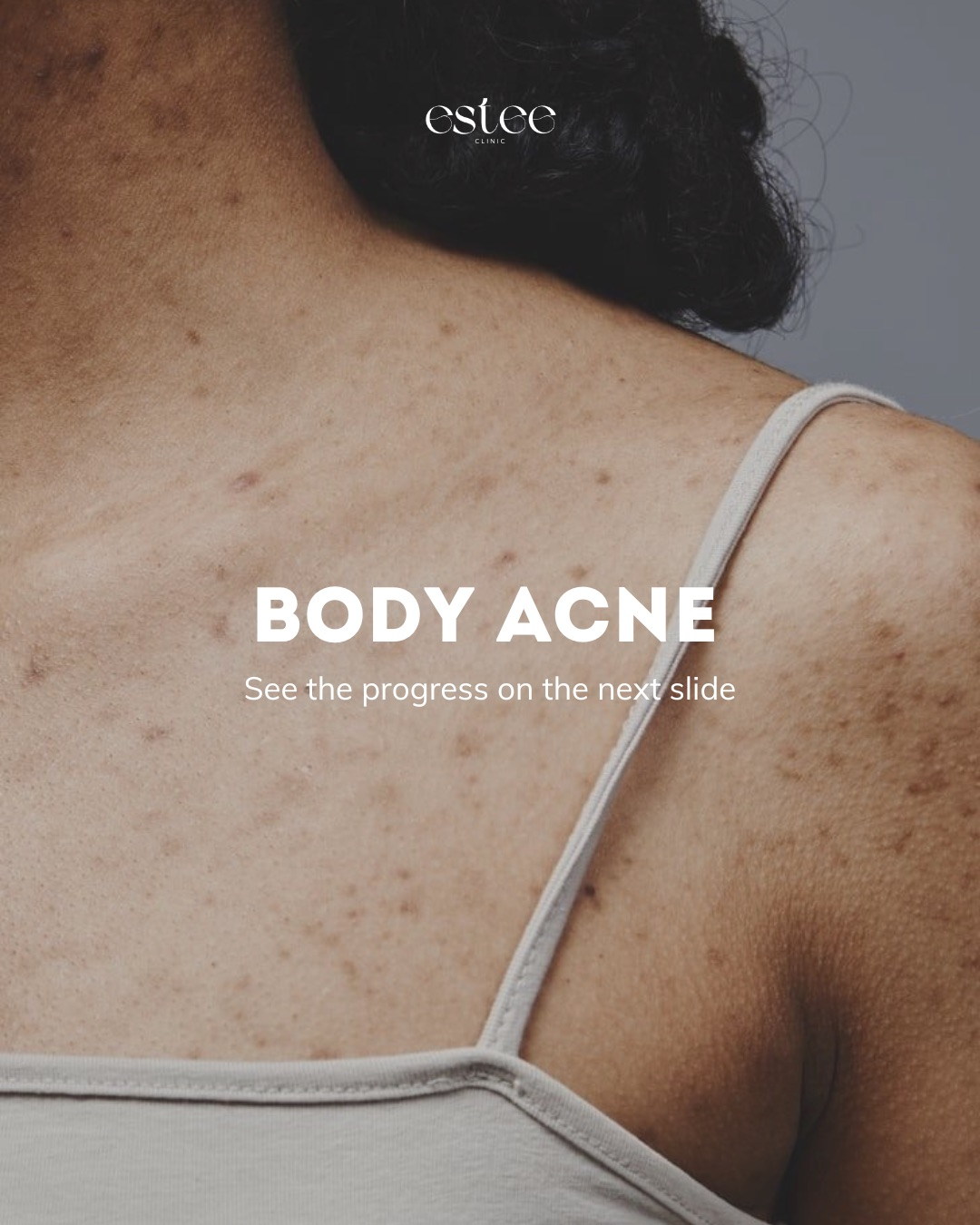 Estee Clinic — разбор состояния кожи