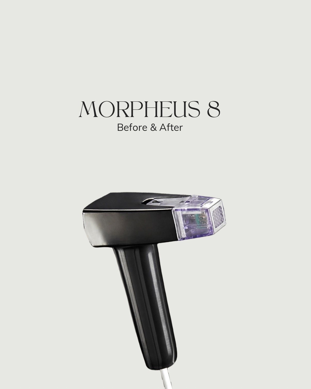 Estee Clinic — Morpheus 8: до и после