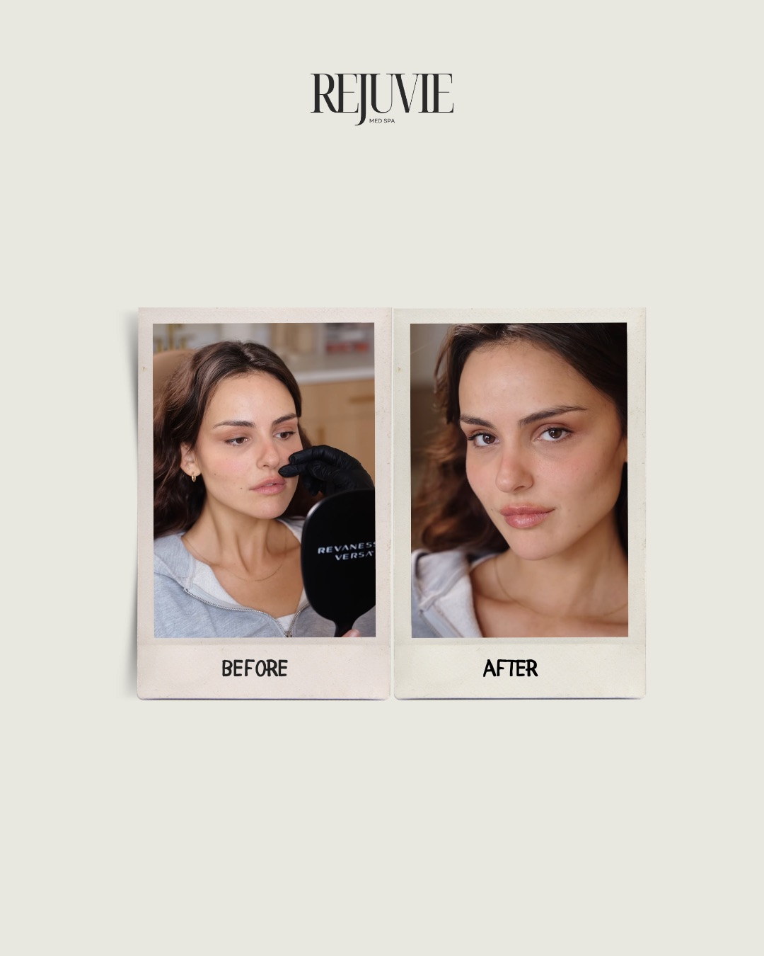 Rejuvie Med Spa — пример «до и после»